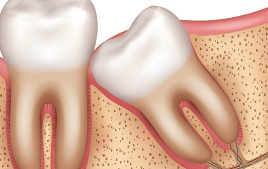 The Mystery of Wisdom Teeth You’ve Been Wondering About